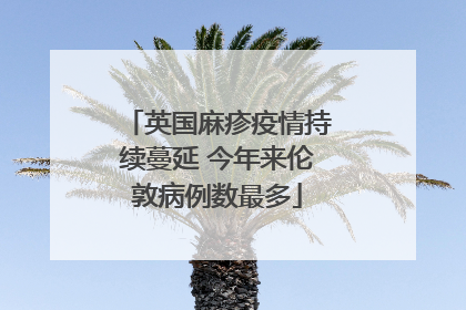 英国麻疹疫情持续蔓延 今年来伦敦病例数最多
